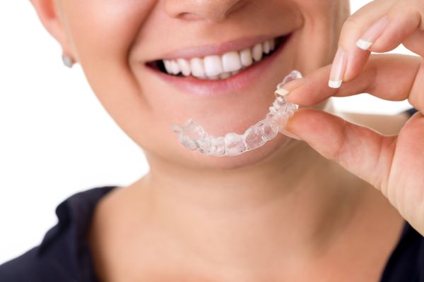 clear aligners