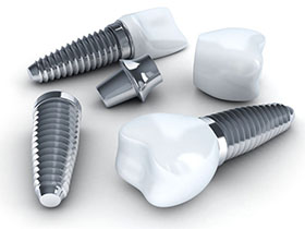 Am I a Candidate for Dental Implants