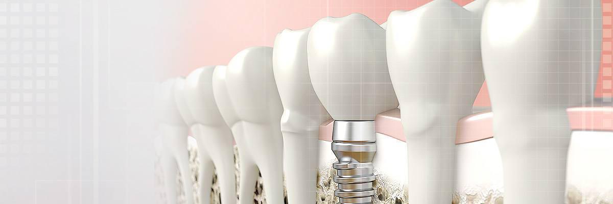 Blaine Dental Prosthetics