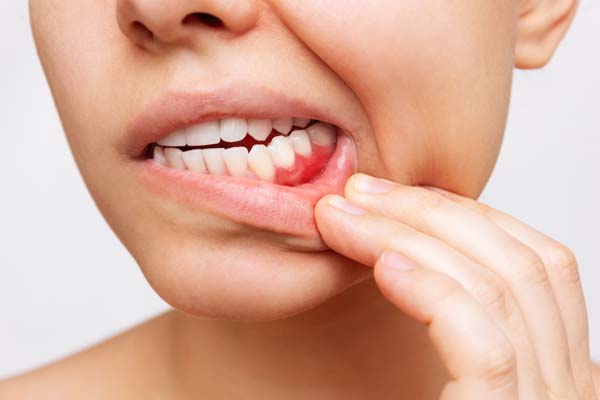 Can Gum Disease Be Prevented?