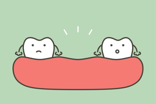 Why It Is Important To Replace Missing Teeth