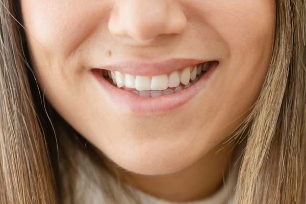 How A Smile Makeover Can Boost Your Confidence