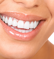 Teeth Whitening Services Blaine, MN